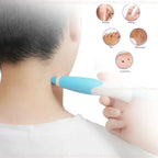 DermoPen TR-36™ | Kit Profissional para Remoção de Verrugas e Sinais